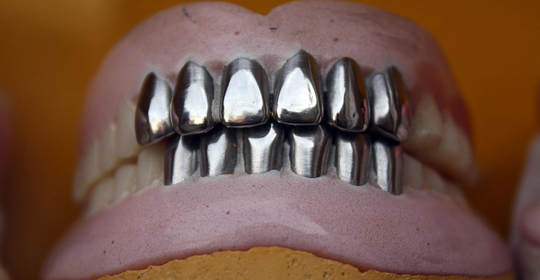 corone metalliche