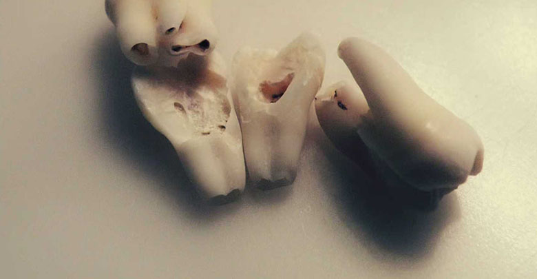 Get Rid of Bad Breath