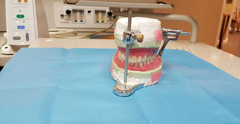 Implant Supported Dentures VS Traditional Dentures 1
