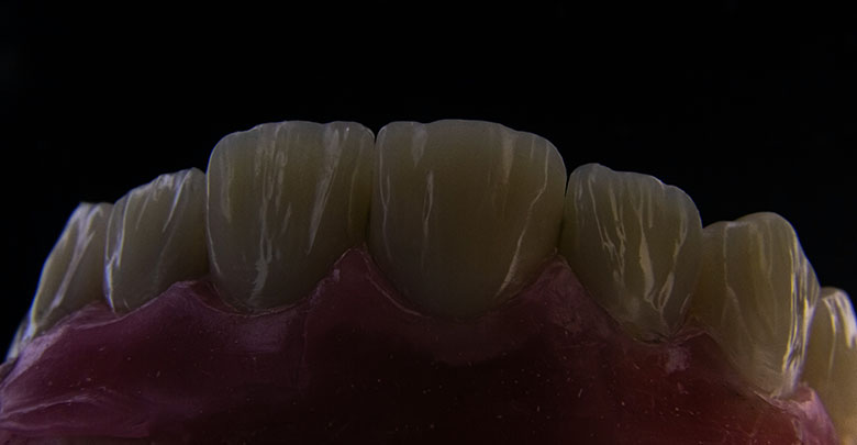 Keep your teeth clean