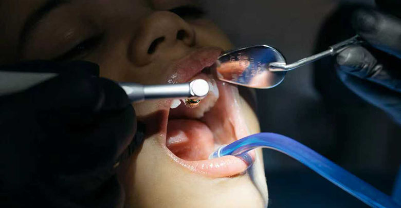 Signs of tooth decay