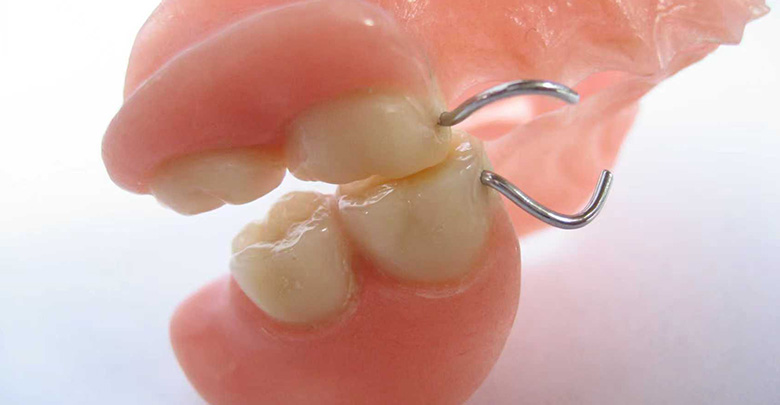 Traditional Dentures