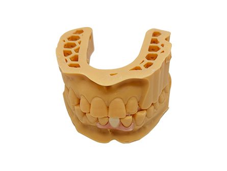 Custom Dentures | High-Quality Dental Lab Solutions | Istar