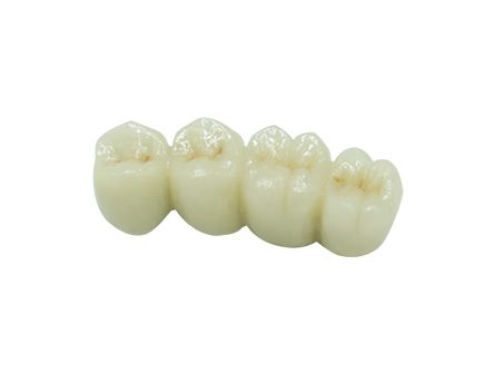 Mostek PFM dla tylnej części