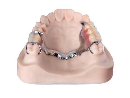 Protesi metallica stampata in 3D