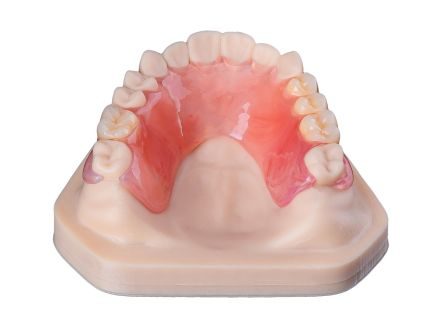 Stampa 3D di protesi parziali superiori Stampa 3D di protesi parziali superiori