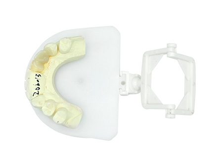 zirconia Maryland bridge zirconia Maryland bridge