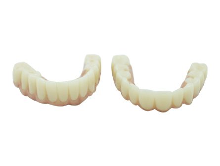 Implants dentaires All On 5 Implants dentaires All On 5