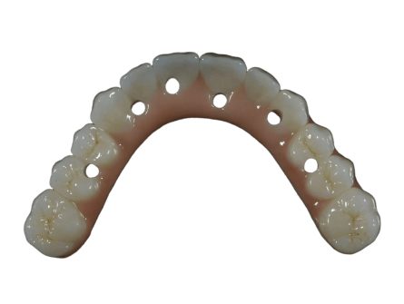 Implant dentaire All-On-6 Implant dentaire All-On-6