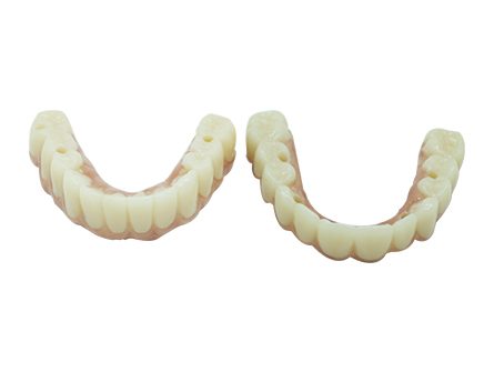 All on 6 Zahnimplantate