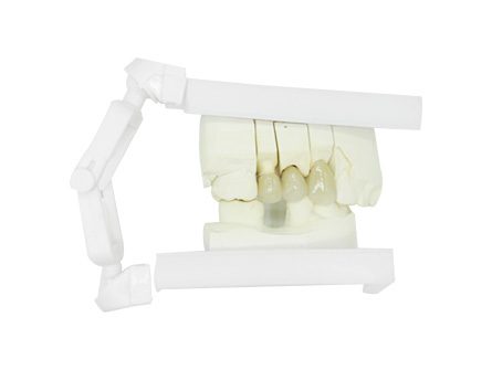 Keramik-Metall-Verbundkrone