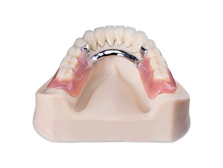 Chrom-Kobalt-Zahnersatz