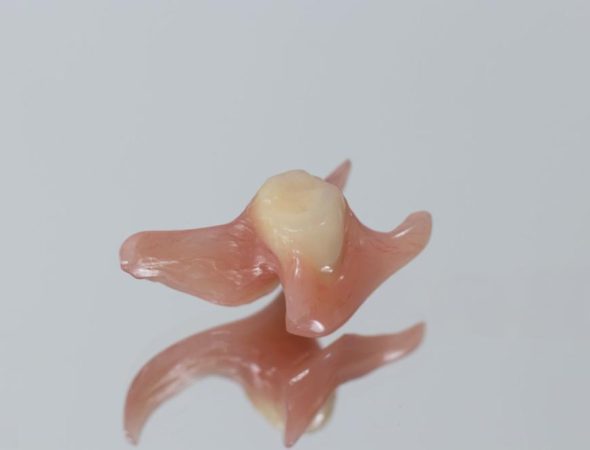 Ventajas clínicas de la prótesis unitaria Flexi Denture Ventajas clínicas de la prótesis unitaria Flexi Denture
