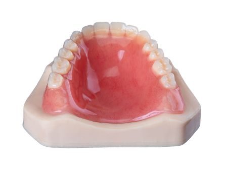 Vollständige Prothese Oberkiefer
