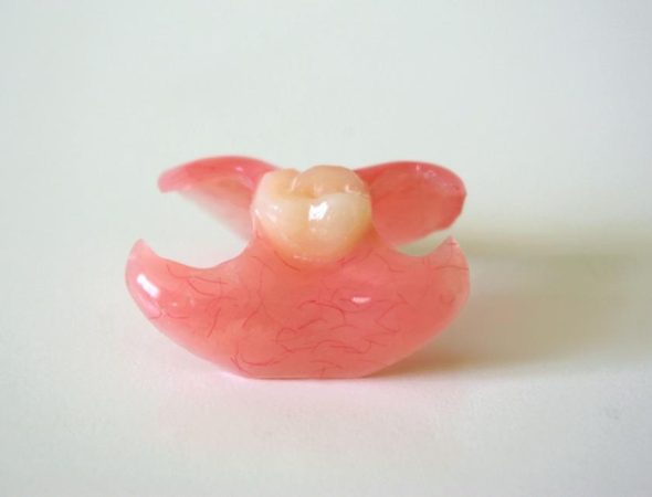 Dentadura flexible a medida para un diente Dentadura flexible a medida para un diente