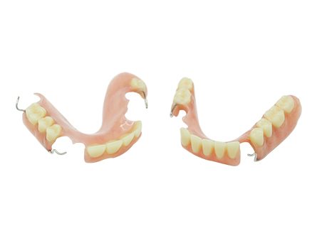 Zahnersatz mit Klammern