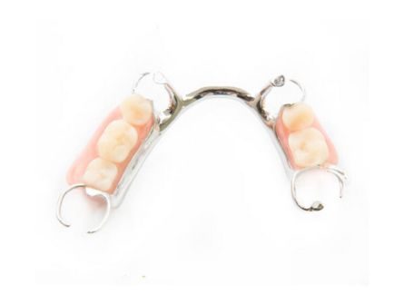 Protesi flessibile con metallo-1 Protesi flessibile con metallo-1