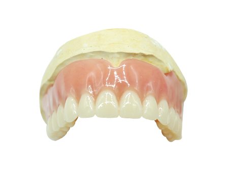 유연한 틀니 유연한 틀니