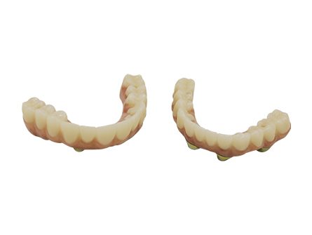 Couronne zircone stratifiée en bouche complète Couronne zircone stratifiée en bouche complète