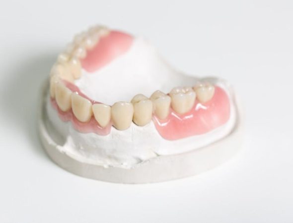 Istar Ventajas técnicas de la prótesis dental flexible de un solo diente Istar Ventajas técnicas de la prótesis dental flexible de un solo diente