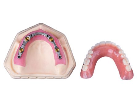 Implantater til nedre tandproteser Implantater til nedre tandproteser