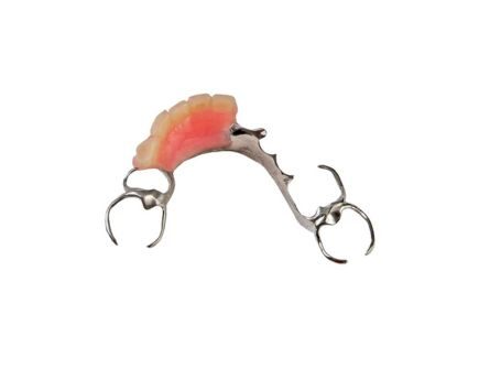 Protesi metalliche per denti anteriori-1 Protesi metalliche per denti anteriori-1