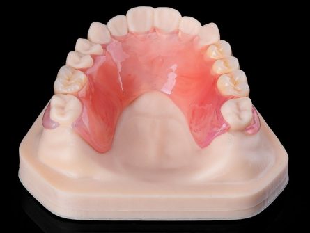 Partial acrylic denture