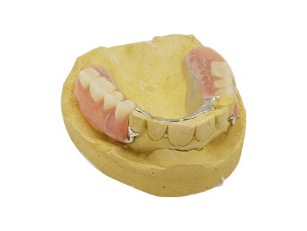 Protesi Vitallium-2 Protesi Vitallium-2